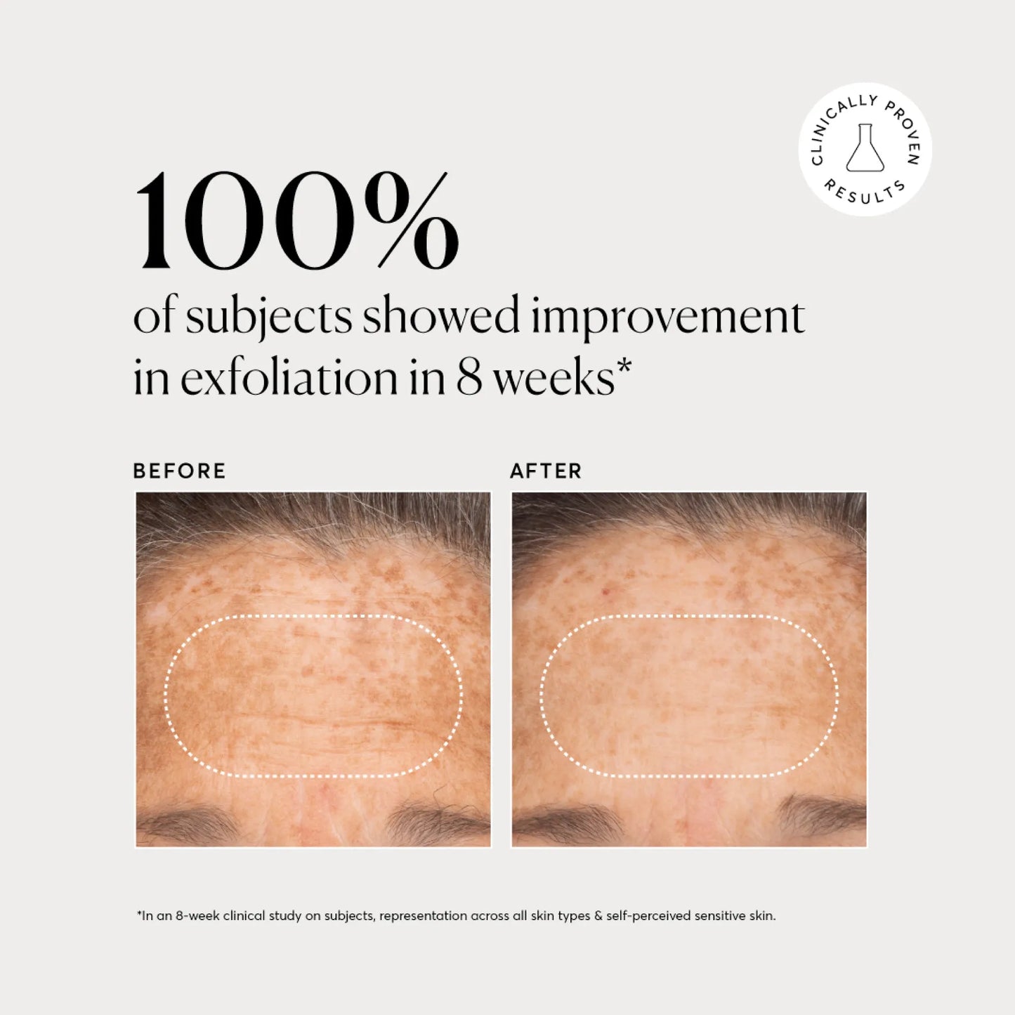 bha-liquid-exfoliant-2-j6 NATR-10027-Alt-Images-BHA-Liquid-Exfoliant-2_-03.webp