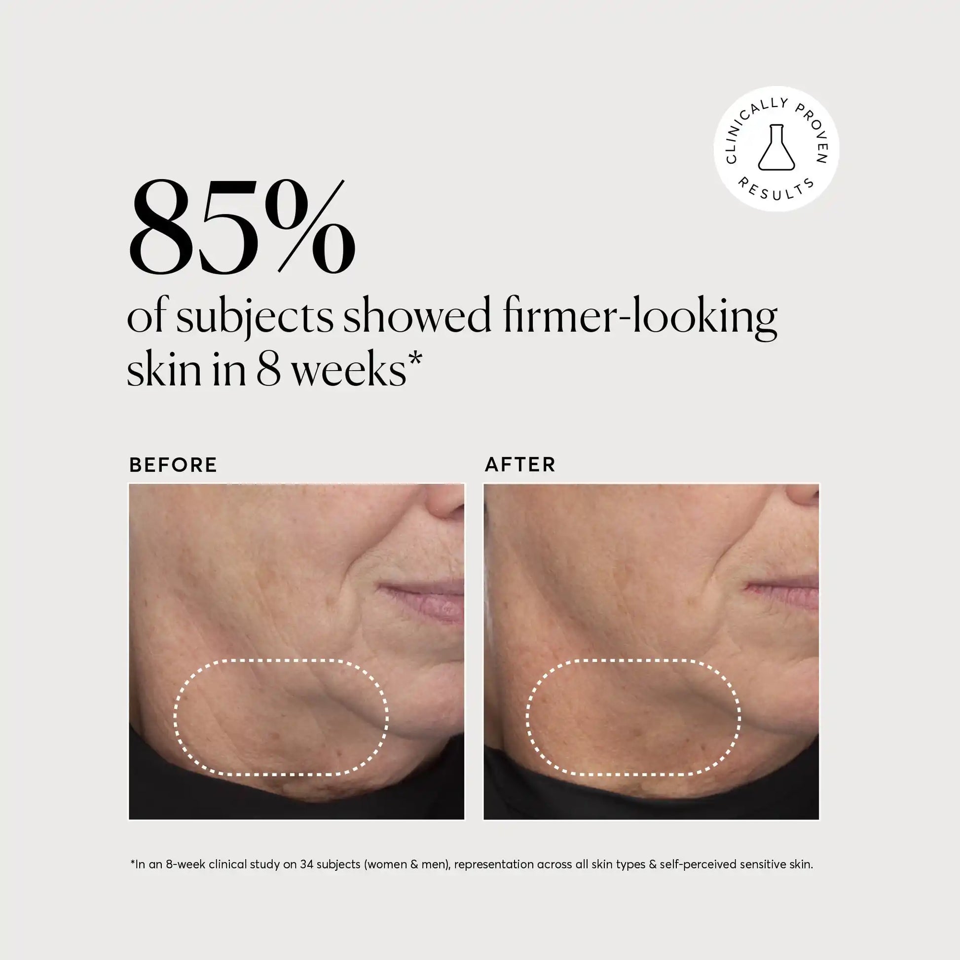 retinol-complex-serum-z6 NATR-10034-Alt-Images-Retinol-Complex-Serum-04.webp